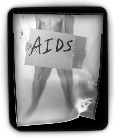 Aids