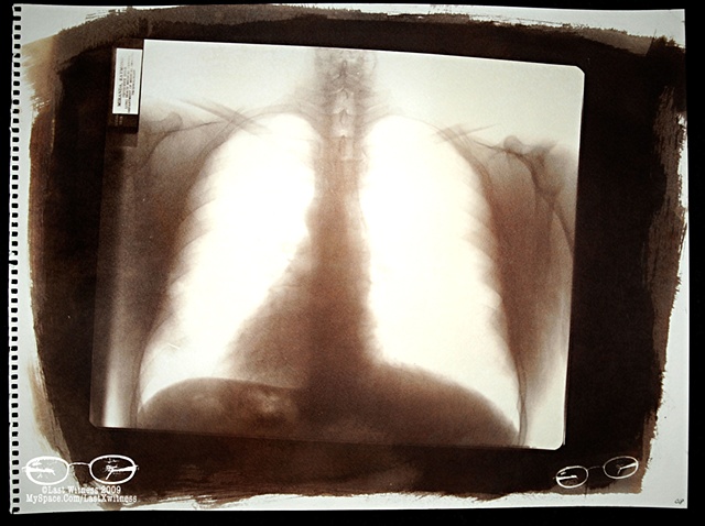 Van Dyke Brown created from my fathers  chest xray