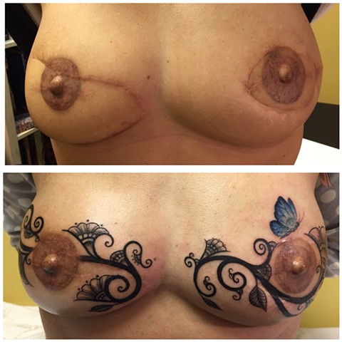Scar cover up tattoo, scar tattoo, breast cancer tattoo, breast reconstruction tattoo, ct Tattooers, ct tattoo, 3D tattoo, 3D areola tattoo