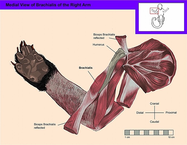 Medial View of the Deep Muscles of the Right Arm and Shoulder [Brachialis]