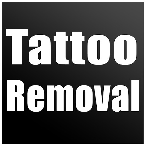 Tattoo REMOVAL