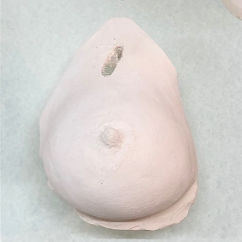 Exempel breast no 21