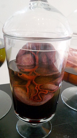 Spleen in Jar