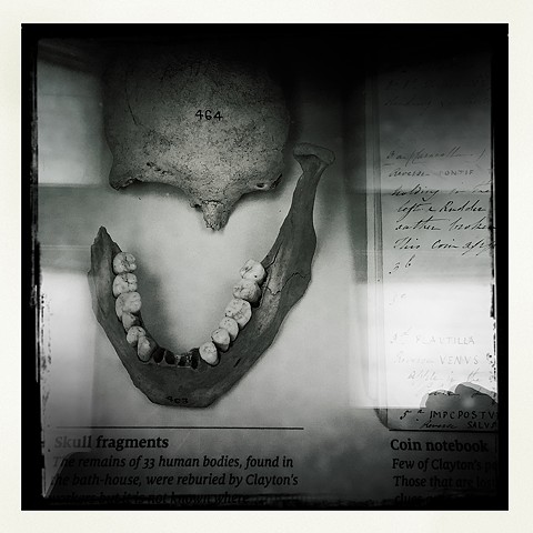 Chesters Museum - Human Skull