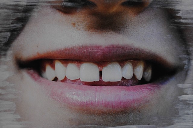 teeth ii