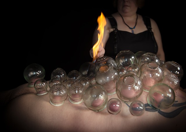 Woman does fire play and erotic cupping with 30 cups on a man's back photographed by La Mouge Erotic Photo