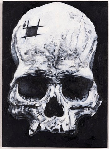 Trepanned Skull (Ephraim George Squier (1821-1888)