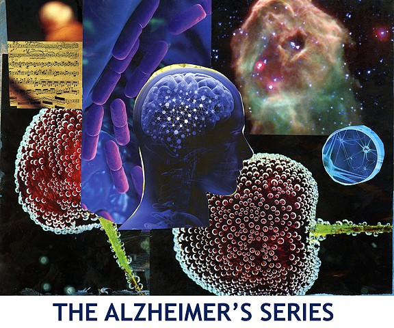 Alzheimer's Series