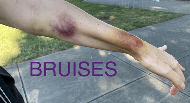 Bruises FX