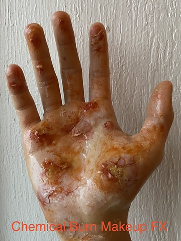 Chemical Burn FX