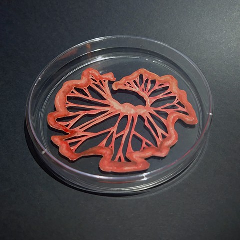 Mesentery Arteries #3