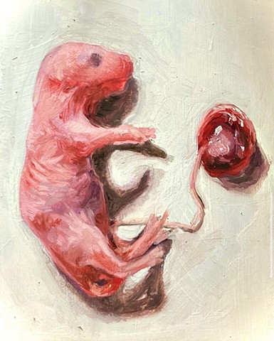 Fetus