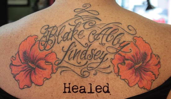 Back - Healed