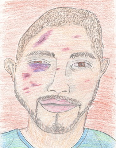 Colored pencil portrait drawing of a bruised young man by Christopher Stanton