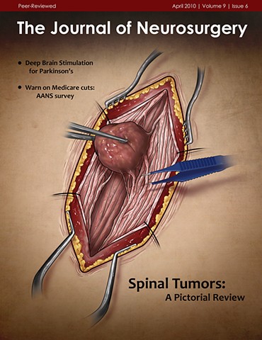 The Journal of Neurosurgery