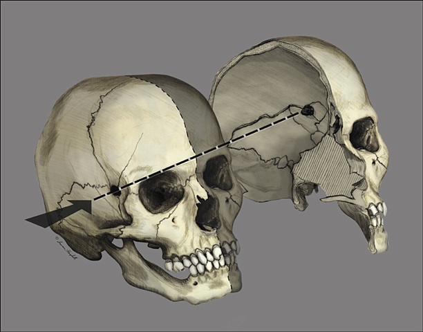 Digital Illustration: Forensic Reconstruction | Lauren Hemphill