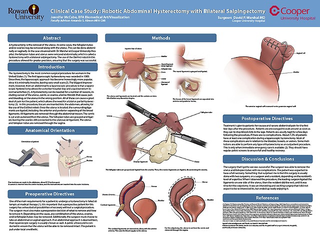 Surgical Illustration Research Poster by Jennifer McCabe 