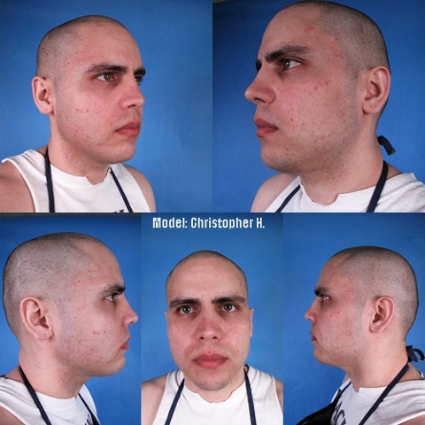 Christopher Hernandez (before)