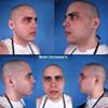 Christopher Hernandez (before)