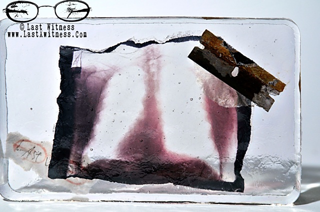 photo emulision of my fathers chest x-ray suspended in resin with rusted single edge razor blade