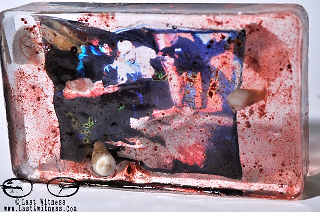 photo emulsion of "justin" from the testimony series suspended in resin with real human teeth and artificial blood