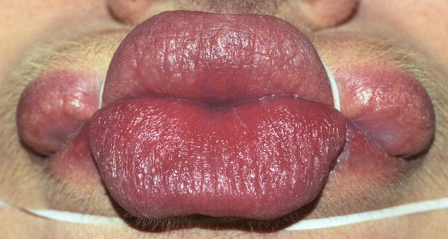 Anika Smulovitz Lips Untitled Manipulate 4