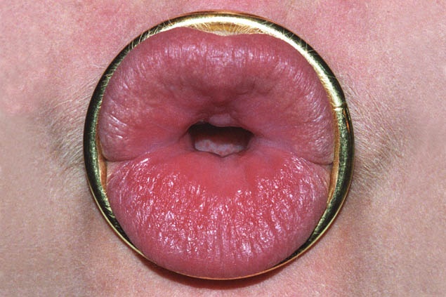 Smulovitz Lips Untitled (ring)