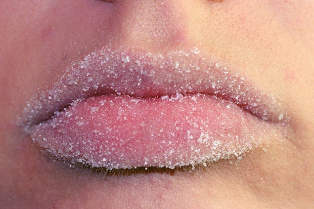Anika Smulovitz Lips Untitled sugar