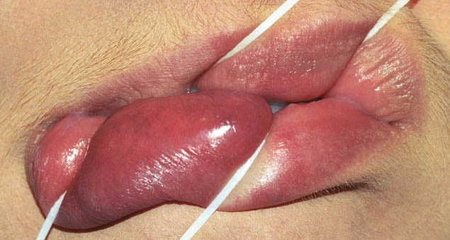 Anika Smulovitz Lips Untitled Manipulate 2