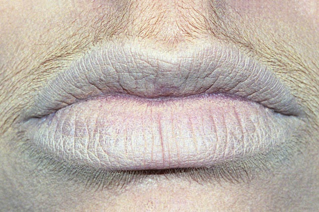 Smulovitz Lips Untitled (neutral)