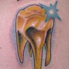 Gold Tooth