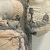 Detail (kidneys)