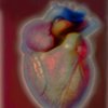The Heart
2014
zone plate photograph
archival pigment print
13"x20”
from "The Atlas of Human Anatomy" by J. M Bourgery and N. H. Jacob, 1832-1854