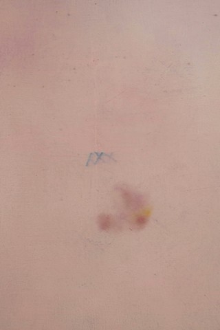 Peau-1 détail