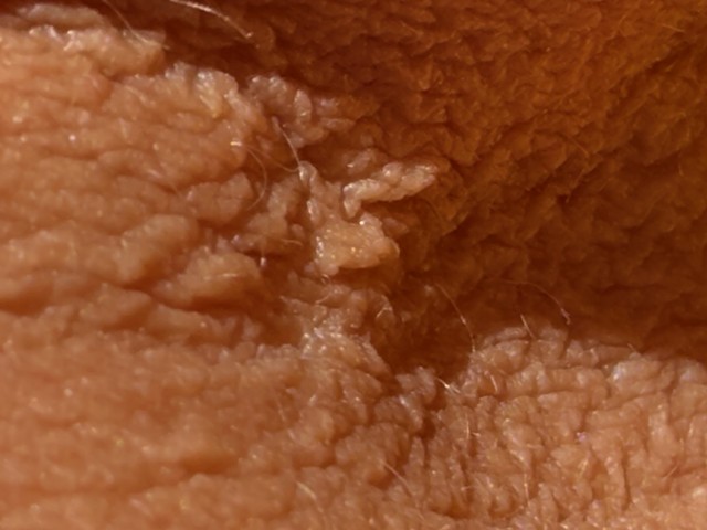 Close up of in bent elbow, inside skin....wow