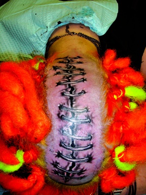 stitches tattoo by tatupaul