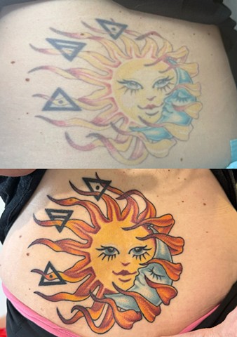 Fix up before and healed after 