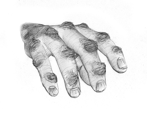 Hand of Argus