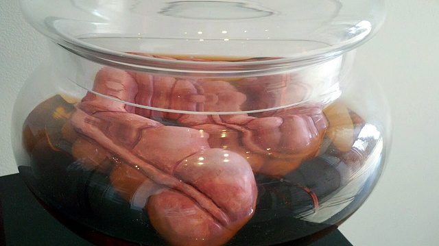 Large Intestine in Jar