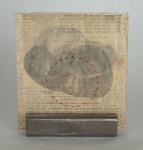 Lois Epperson-Gale, interstitial memory I (back view), Gray's Anatomy page, paper, thread, wax, steel, 2011