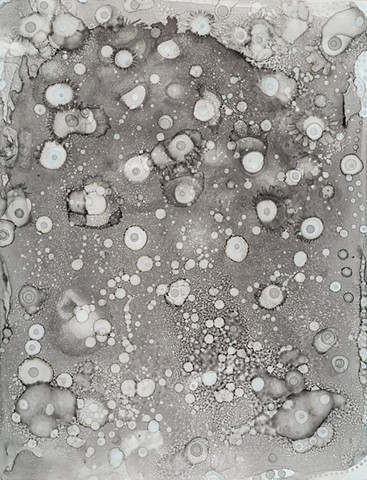 lowenstein mosklow cells islets beta t1d 