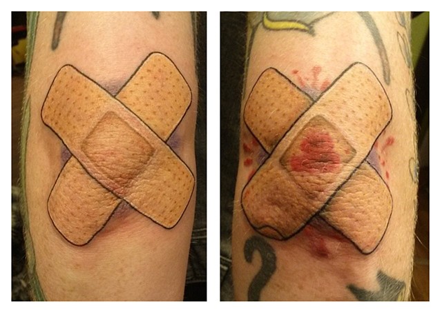 Band-aids on the Elbows