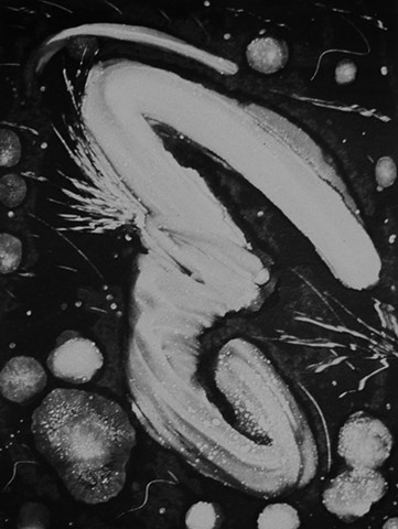 Eruption