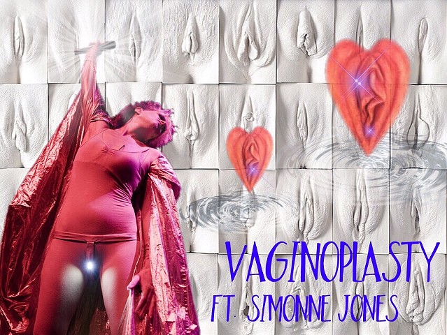 Vaginoplasty (THE GREAT WALL OF VAGINA by Jamie McCartney)