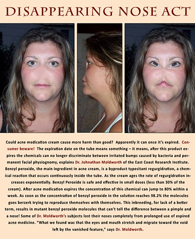 Disappearing Nose Act