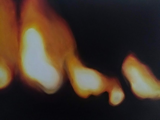 Lighting Fires (2)