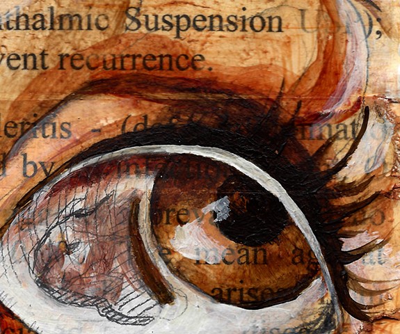 painting, drawing, fine art, eye, eyeball, eyes, vision, medicine, medical, anatomy, anatomical, natural, scleritis, text, detail