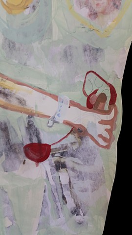 hospital, painting, fine art, hospital gowns, figurative, kidney, kidney stones, childhood, detail