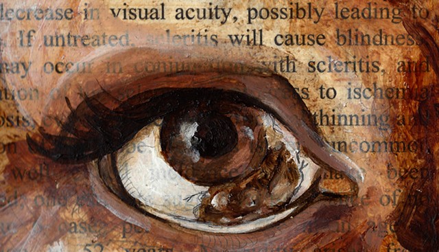 medical illustration, paint, painting, fine art, drawing, text, medical text, medical literature, eye, eyes, eyeball, eyeballs, anatomy, anatomical, scientific, medical, grotesque, disturbing, nasty, morbid, morbidity, disease, medical condition, eye cond