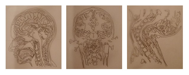 study, drawing, graphite, fine art, brain, encephalon, mri, MRI, medical, anatomy, anatomical, medical illustration, flexion, extension, skull, head, human, human body, spine